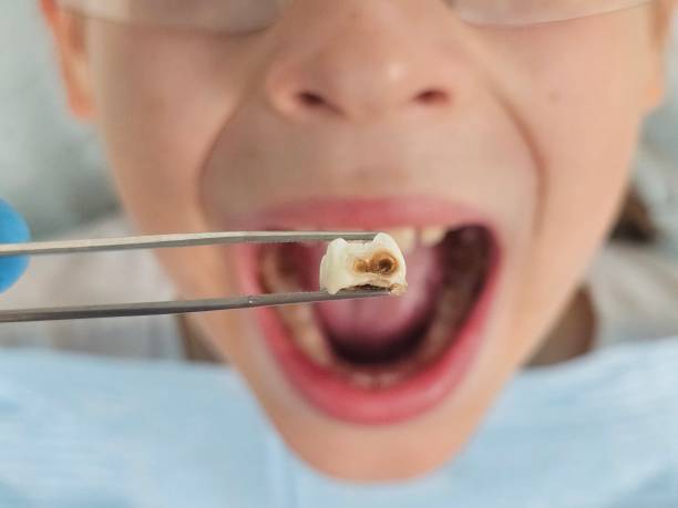 Best Emergency Treatment for Toothache in Ashland, PA